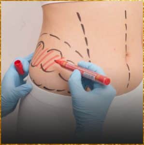liposuction anasayfa1
