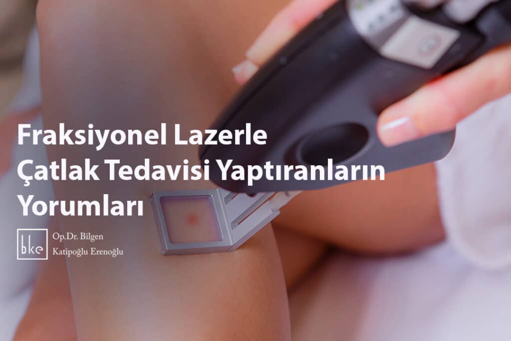 Fraksiyonel Lazerle Çatlak Tedavisi Yaptıranların Yorumları​