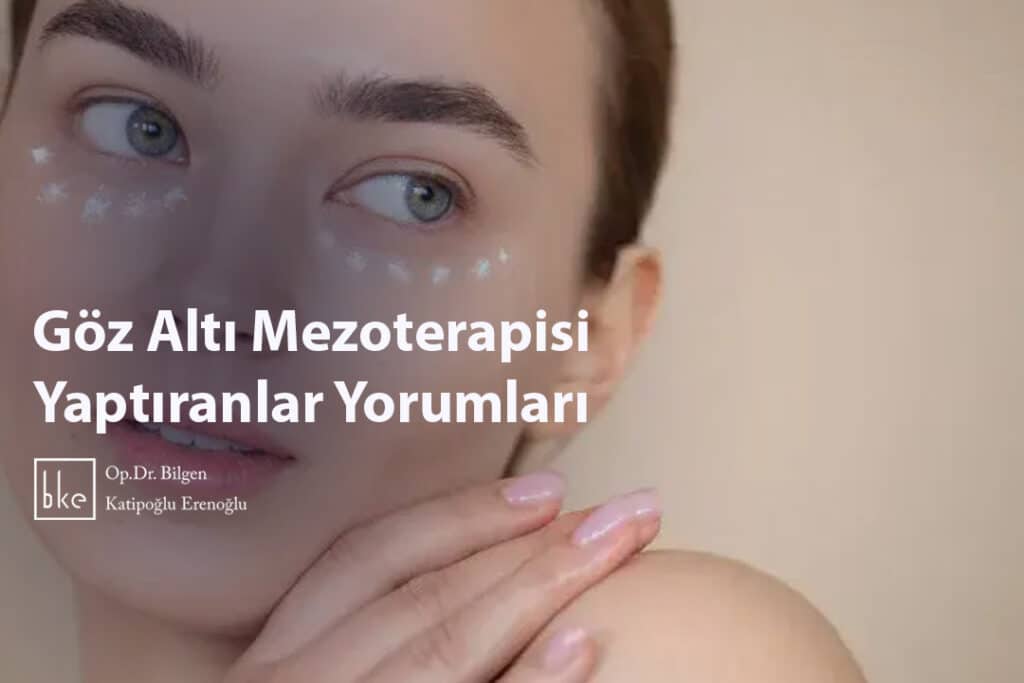 Göz Altı Mezoterapisi Yaptıranlar Yorumları