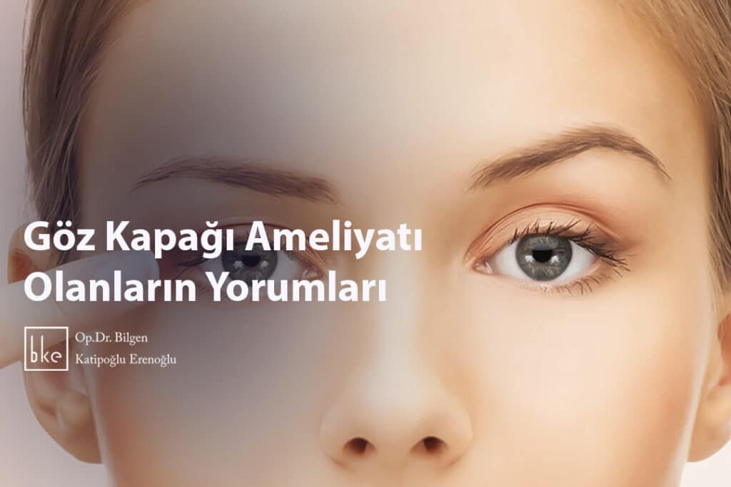 Göz Kapağı Ameliyatı Olanların Yorumları