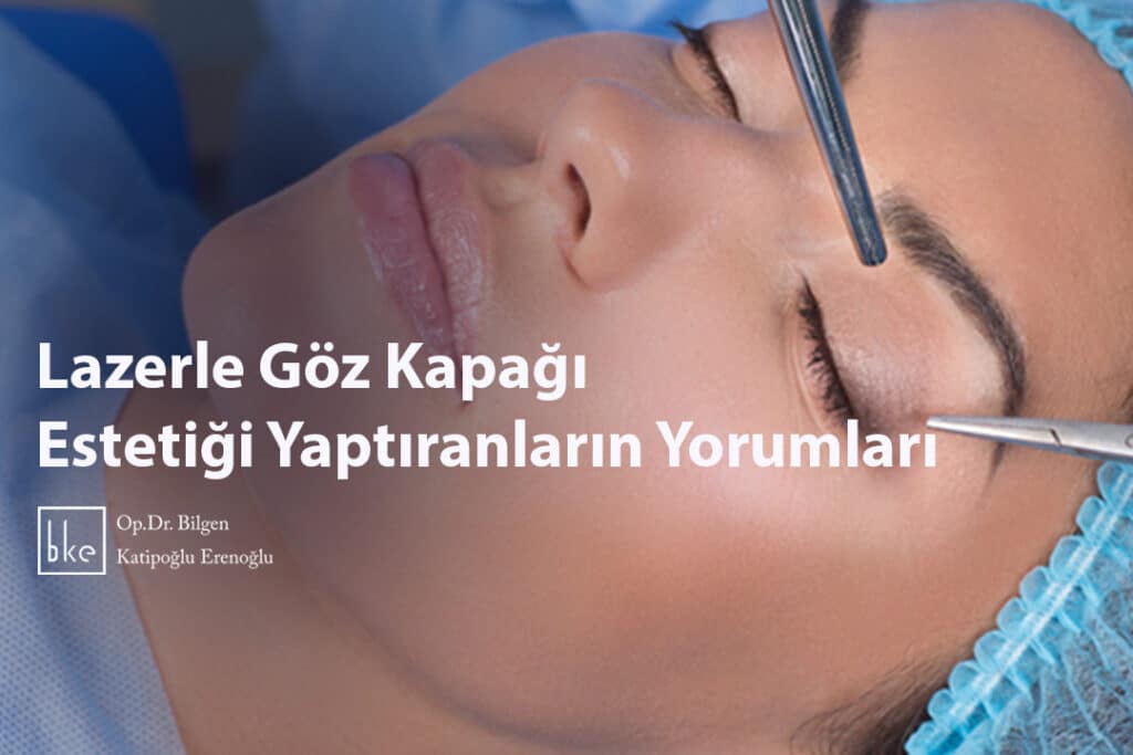 Lazerle Göz Kapağı Estetiği Yaptıranların Yorumları​