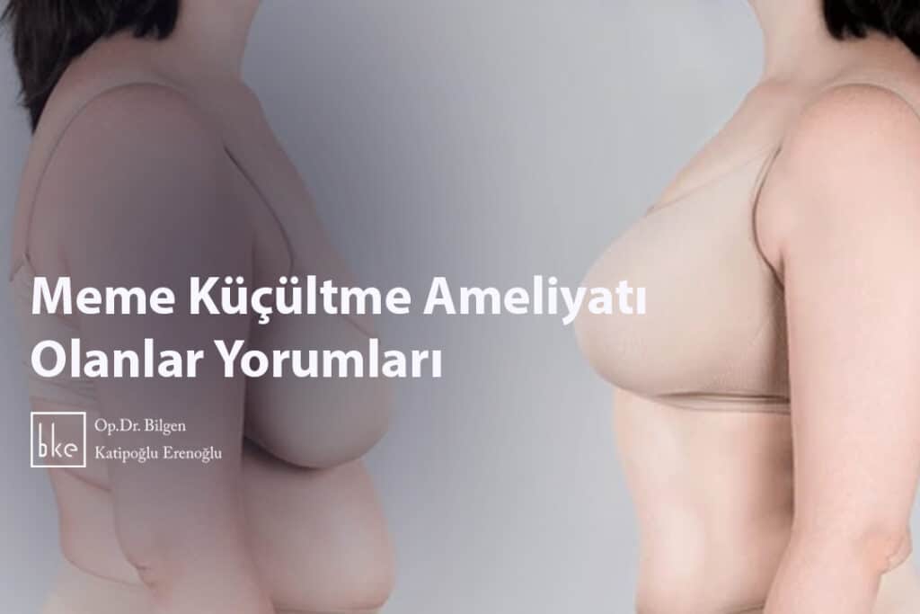 Meme Küçültme Ameliyatı Olanlar Yorumları