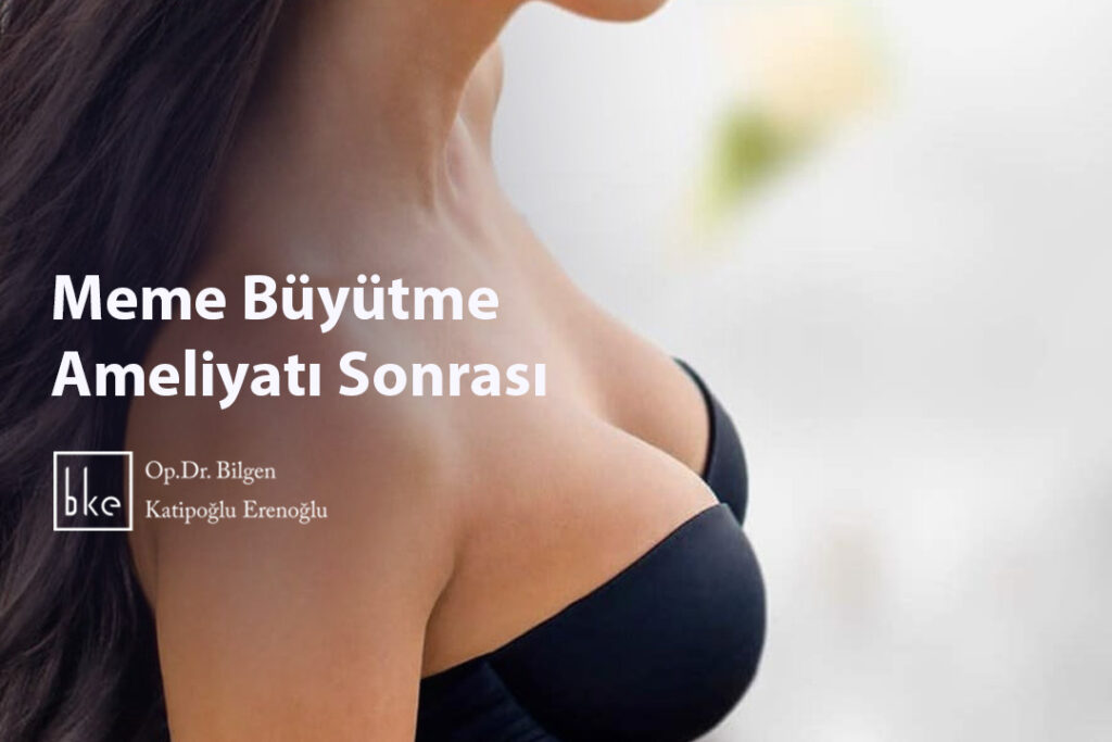 Meme Büyütme Ameliyatı Sonrası