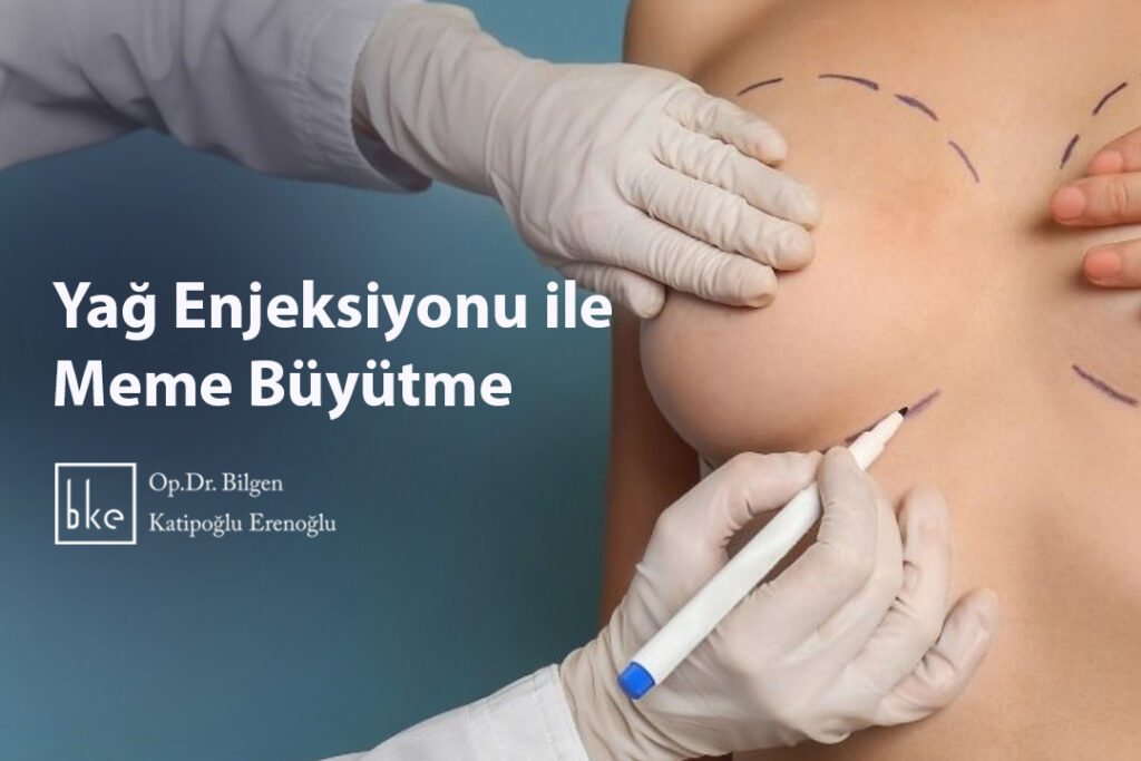 Yağ Enjeksiyonu ile Meme Büyütme
