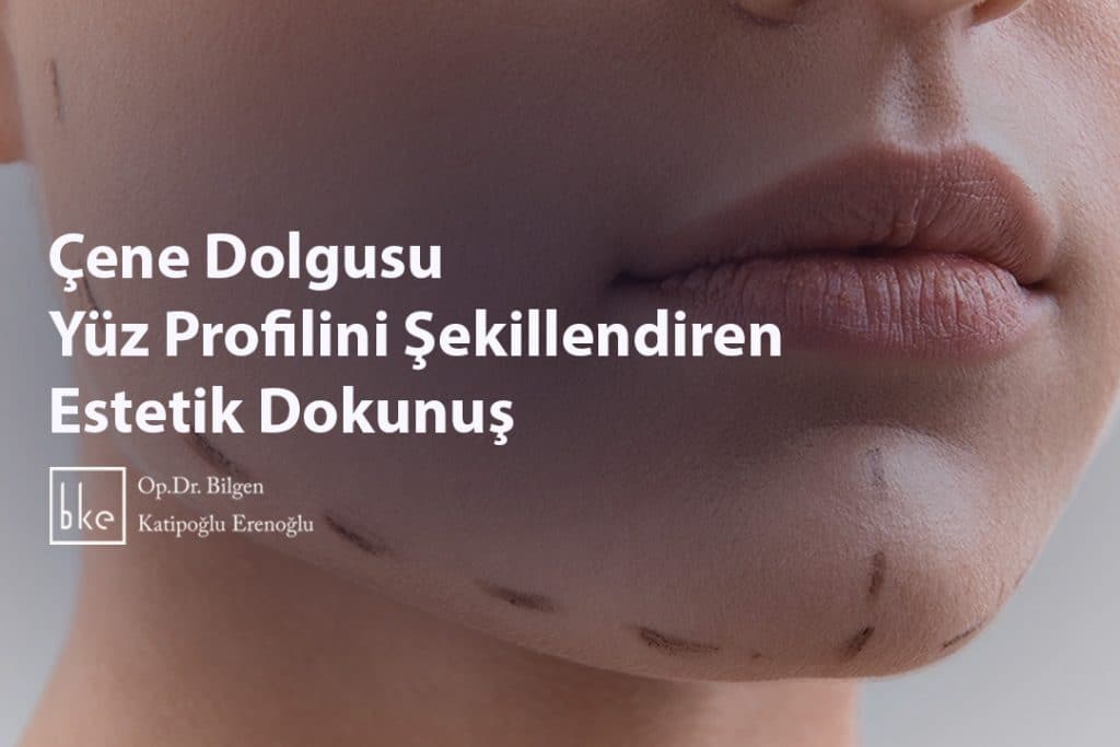 Çene Dolgusu Yüz Profilini Şekillendiren Estetik Dokunuş