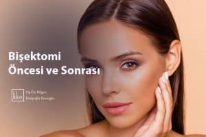 Bişektomi Öncesi ve Sonrası