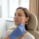 Radiesse dolgu uygulaması öncesi çene hattına işaret kalemiyle planlama çizgileri çizilmesi